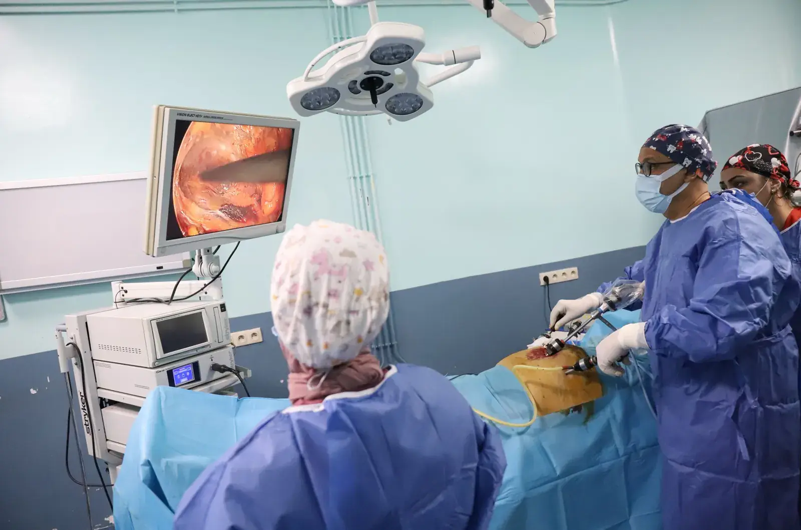 Images laparoscopiques pendant la cure de hernie