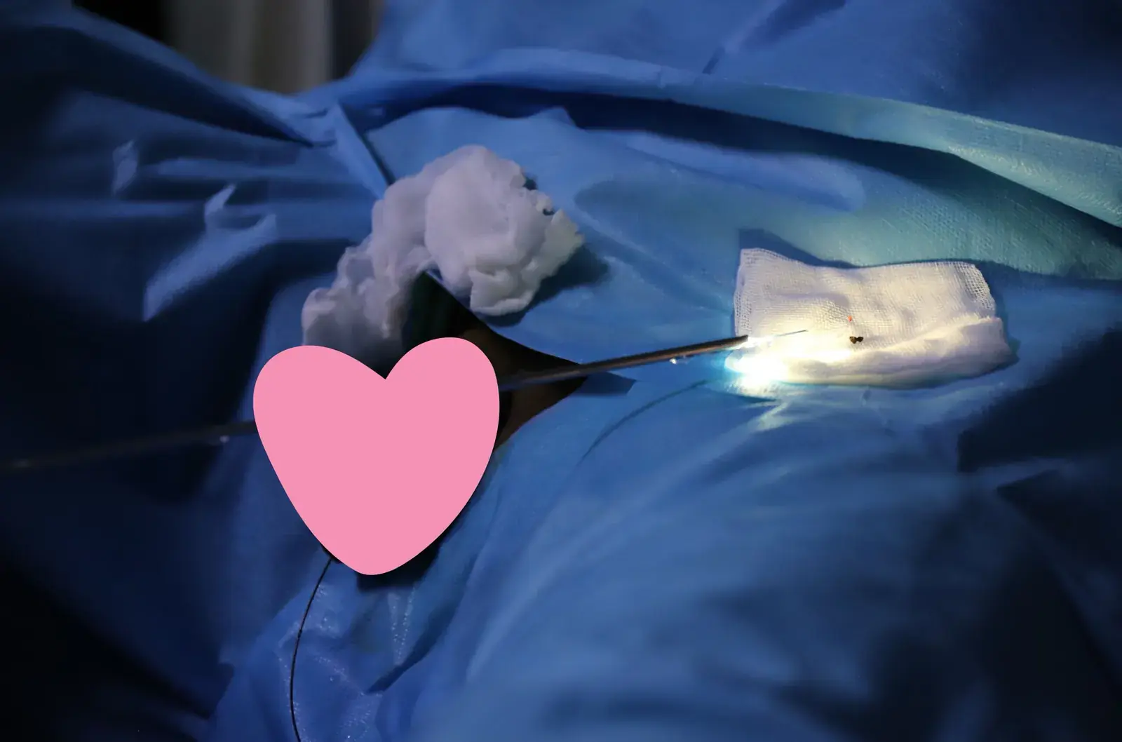 Fibre laser Thulium utilisée en bloc opératoire